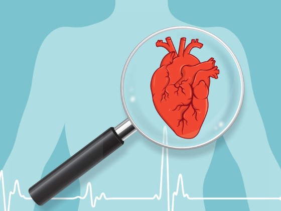 CBD je mimo iného cenené aj pre svoje pozitívne účinky pri liečbe kardiovaskulárnych ochorení